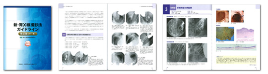新・胃Ｘ線撮影法ガイドライン 01