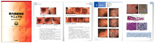 胃内視鏡検診マニュアル